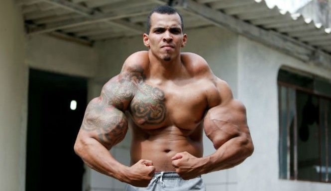 Bodybuilder-Injections-Arms-Turned-To-Rock-Synthols-Fake-Muscles-Almost-Kill-A-Man-665x385.jpg