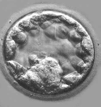 fertilization-+embryo-blastocyst-time-lapse.jpg