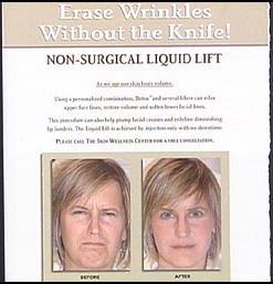 funny-before-after-facelift-liquid.jpg