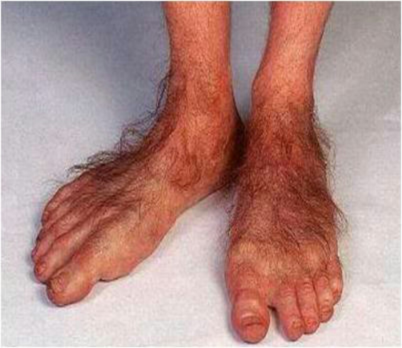 hobbit-feet1-1280x1108.jpg