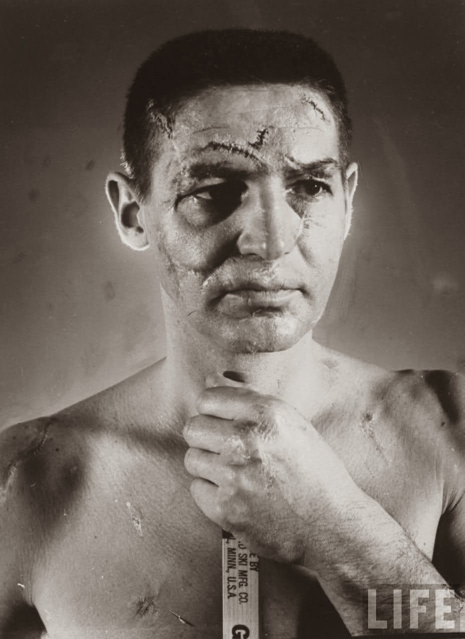 Terry Sawchuk The face of a hockey goalie before masks became standard game equipment, 1966.jpg