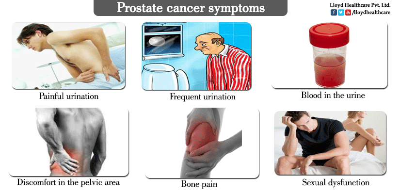 Prostate-cancer-symptoms..png