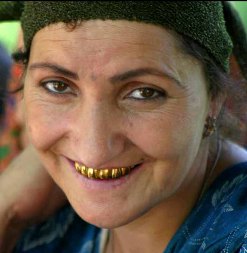 tajikistan_gold_teeth.jpg